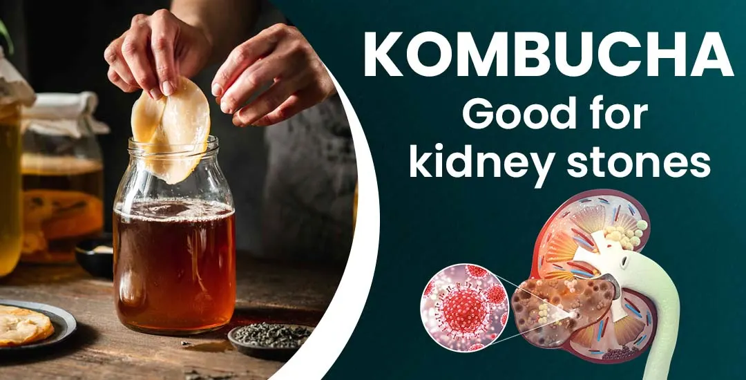 Is Kombucha Good for Kidney Stones? 